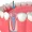 render-tratamiento-endodoncia